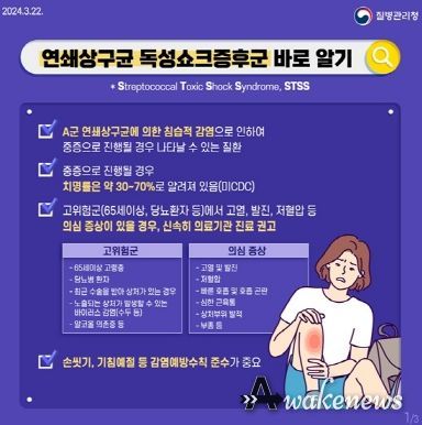 STSS 질환 예방을 위한 위생 수칙 준수 당부